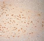 SNAP 47 Antibody in Immunohistochemistry (Paraffin) (IHC (P))