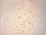 SNAP 47 Antibody in Immunohistochemistry (Paraffin) (IHC (P))