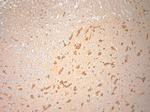 SNAP 47 Antibody in Immunohistochemistry (Paraffin) (IHC (P))