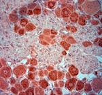 Synaptopodin Antibody in Immunohistochemistry (Paraffin) (IHC (P))