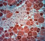 Synaptopodin Antibody in Immunohistochemistry (Paraffin) (IHC (P))