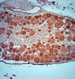 Synaptopodin Antibody in Immunohistochemistry (Paraffin) (IHC (P))