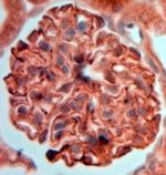 Synaptopodin Antibody in Immunohistochemistry (Paraffin) (IHC (P))