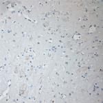 SFT2A Antibody in Immunohistochemistry (Paraffin) (IHC (P))