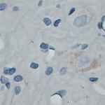 SFT2A Antibody in Immunohistochemistry (Paraffin) (IHC (P))