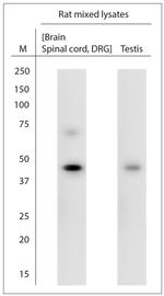 Septin 2 Antibody in Western Blot (WB)