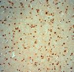 Striatin 4 Antibody in Immunohistochemistry (Paraffin) (IHC (P))