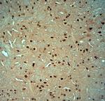 Striatin 4 Antibody in Immunohistochemistry (Paraffin) (IHC (P))