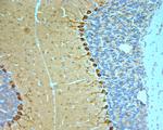 STXB1 Antibody in Immunohistochemistry (Paraffin) (IHC (P))