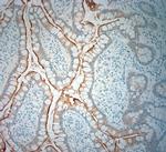 SLC5A8 Antibody in Immunohistochemistry (Paraffin) (IHC (P))