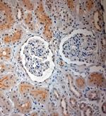 SLC17A3 Antibody in Immunohistochemistry (Paraffin) (IHC (P))
