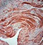 SNTB1 Antibody in Immunohistochemistry (Paraffin) (IHC (P))