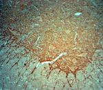 Synaptophysin Antibody in Immunohistochemistry (Paraffin) (IHC (P))