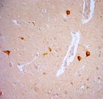 TRPV1 Antibody in Immunohistochemistry (Paraffin) (IHC (P))