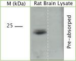 TRAPPC5 Antibody in Western Blot (WB)