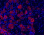 TrkC Antibody in Immunocytochemistry (ICC/IF)