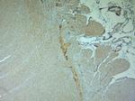 TRPV2 Antibody in Immunohistochemistry (Paraffin) (IHC (P))