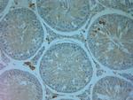 TRPV4 Antibody in Immunohistochemistry (Paraffin) (IHC (P))
