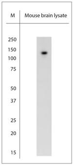 TRPC6 Polyclonal Antibody
