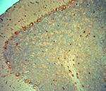 TRPM4 Antibody in Immunohistochemistry (Paraffin) (IHC (P))