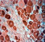 Tau Antibody in Immunohistochemistry (Paraffin) (IHC (P))