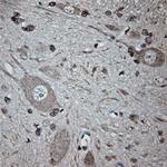 Tubulin beta Antibody in Immunohistochemistry (Paraffin) (IHC (P))