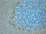 TMEM37 Antibody in Immunohistochemistry (Paraffin) (IHC (P))