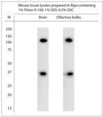 TRPC4 Antibody in Western Blot (WB)