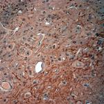 VPS45 Antibody in Immunohistochemistry (Paraffin) (IHC (P))