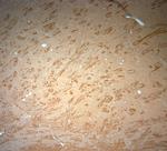 VPS45 Antibody in Immunohistochemistry (Paraffin) (IHC (P))