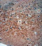 VPS45 Antibody in Immunohistochemistry (Paraffin) (IHC (P))