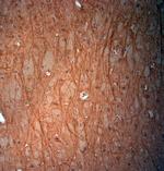 VPS45 Antibody in Immunohistochemistry (Paraffin) (IHC (P))