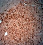 VPS45 Antibody in Immunohistochemistry (Paraffin) (IHC (P))