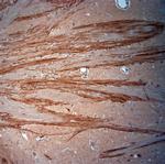 VPS45 Antibody in Immunohistochemistry (Paraffin) (IHC (P))