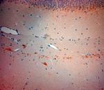 VGluT3 Antibody in Immunohistochemistry (Paraffin) (IHC (P))