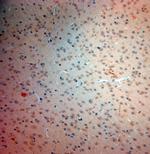 VGluT3 Antibody in Immunohistochemistry (Paraffin) (IHC (P))