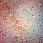 VGluT3 Antibody in Immunohistochemistry (Paraffin) (IHC (P))