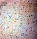 VMAT2 Antibody in Immunohistochemistry (Paraffin) (IHC (P))