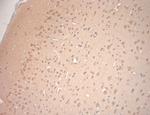 VTI1A Antibody in Immunohistochemistry (Paraffin) (IHC (P))