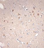 VTI1B Antibody in Immunohistochemistry (Paraffin) (IHC (P))