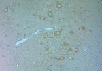 VPS34 Antibody in Immunohistochemistry (Paraffin) (IHC (P))