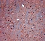 VGluT2 Antibody in Immunohistochemistry (Paraffin) (IHC (P))