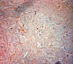 VMAT2 Antibody in Immunohistochemistry (Paraffin) (IHC (P))