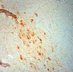 VMAT2 Antibody in Immunohistochemistry (Paraffin) (IHC (P))