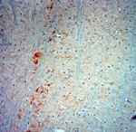 VMAT2 Antibody in Immunohistochemistry (Paraffin) (IHC (P))