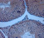 ZO1 Antibody in Immunohistochemistry (Paraffin) (IHC (P))
