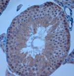 ZO1 Antibody in Immunohistochemistry (Paraffin) (IHC (P))