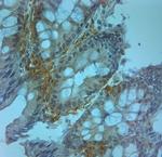 ZO2 Antibody in Immunohistochemistry (Paraffin) (IHC (P))