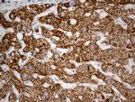 OTC Antibody in Immunohistochemistry (Paraffin) (IHC (P))
