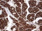 OTC Antibody in Immunohistochemistry (Paraffin) (IHC (P))